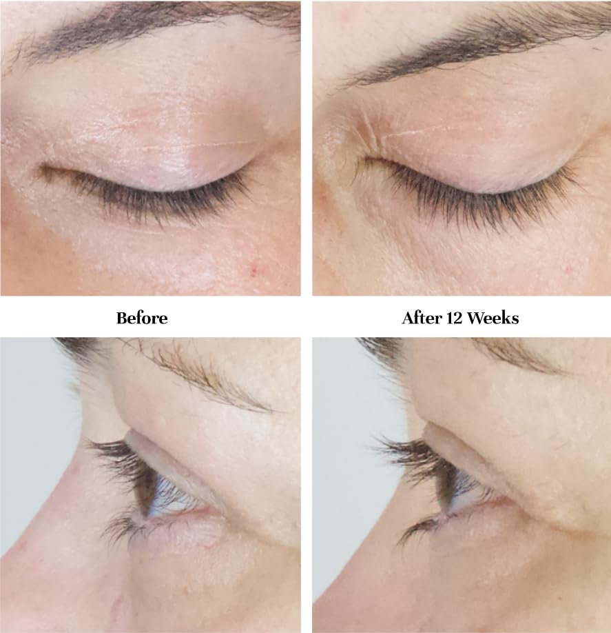 City Beauty City Lash Serum, Eyelash Enhancing Serum, 0.14 Fl Oz